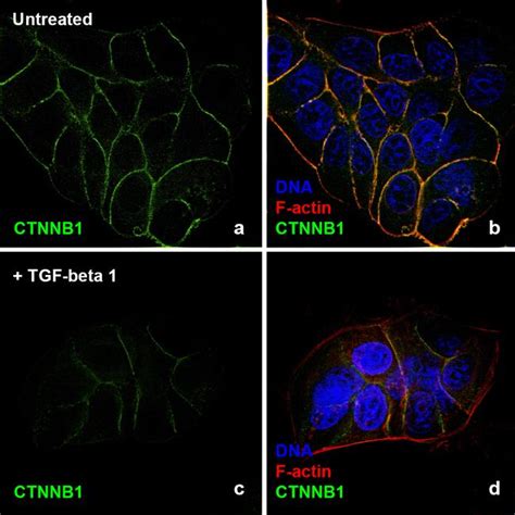tgf beta 1 protein|Human TGF.